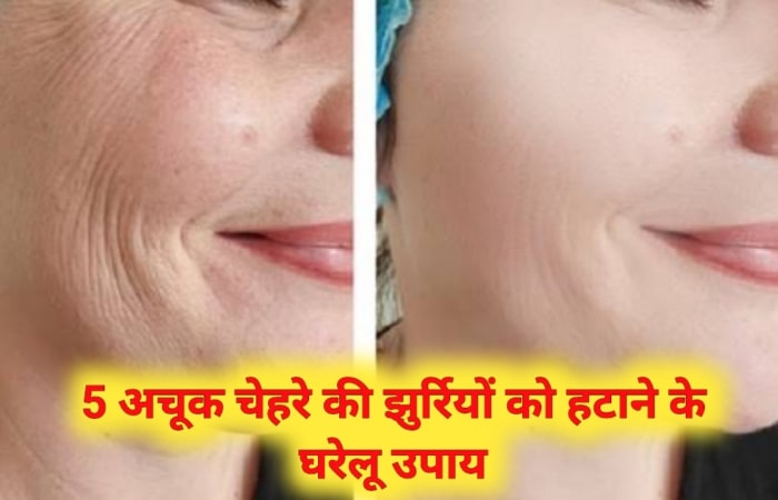 5 अचूक चेहरे की झुर्रियों को हटाने के घरेलू उपाय | Chehre ki jhurriyon ko hatane ke gharelu upay